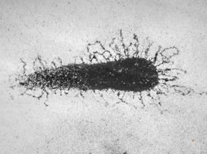 F,7y. | glycocalyx on microvillus - nasal mucosa F,7y. | glycocalyx on microvillus - nasal mucosa